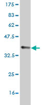 SCN8A monoclonal antibody (M04), clone 4G7