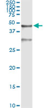 SERPINB3 monoclonal antibody (M01), clone 2F5