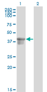 SERPINB3 monoclonal antibody (M01), clone 2F5