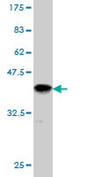 SERPINB3 monoclonal antibody (M01), clone 2F5
