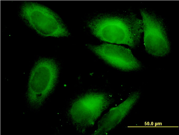 SARS monoclonal antibody (M01), clone 1H4