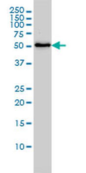 SARS monoclonal antibody (M01), clone 1H4
