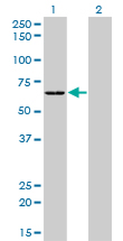 SARS monoclonal antibody (M01), clone 1H4