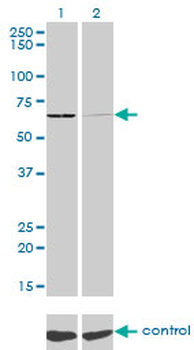 SARS monoclonal antibody (M01), clone 1H4