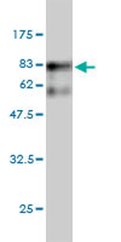 SARS monoclonal antibody (M01), clone 1H4