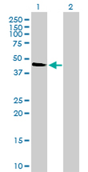 MAPK12 monoclonal antibody (M01), clone 4F4-3D2