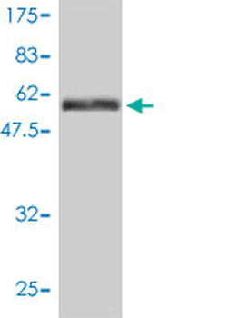 MAPK12 monoclonal antibody (M01), clone 4F4-3D2