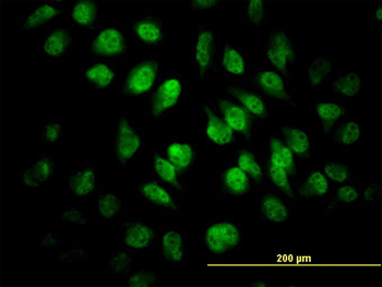 SAFB monoclonal antibody (M04), clone 5A11