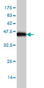 SAFB monoclonal antibody (M04), clone 5A11