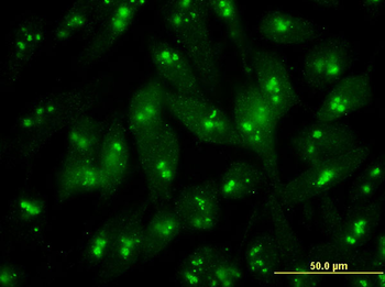 S100B monoclonal antibody (M52), clone 2A10