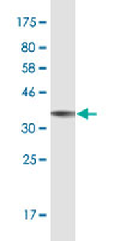 S100B monoclonal antibody (M52), clone 2A10