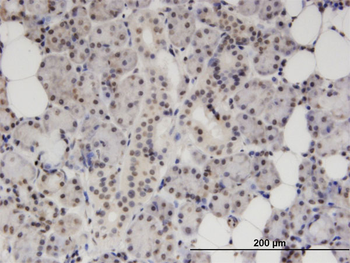 S100B monoclonal antibody (M50), clone 1B2
