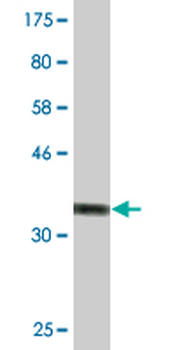 S100B monoclonal antibody (M50), clone 1B2