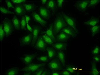 S100A13 monoclonal antibody (M01), clone 3A7