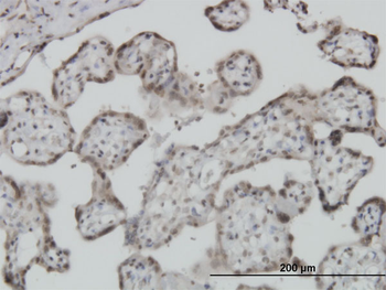 S100A11 monoclonal antibody (M01), clone 2F4