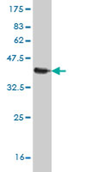 S100A11 monoclonal antibody (M01), clone 2F4