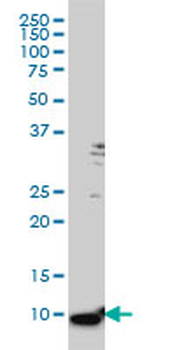 S100A6 monoclonal antibody (M16), clone 6D1