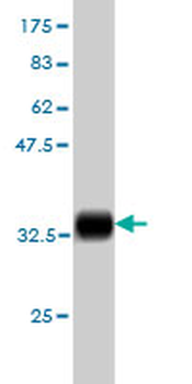 S100A6 monoclonal antibody (M16), clone 6D1