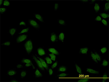S100A6 monoclonal antibody (M10), clone 6B5