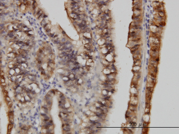 S100A6 monoclonal antibody (M10), clone 6B5