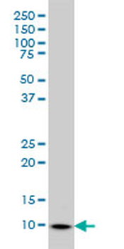 S100A6 monoclonal antibody (M10), clone 6B5