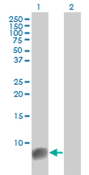 S100A6 monoclonal antibody (M10), clone 6B5