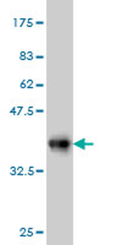 S100A6 monoclonal antibody (M10), clone 6B5
