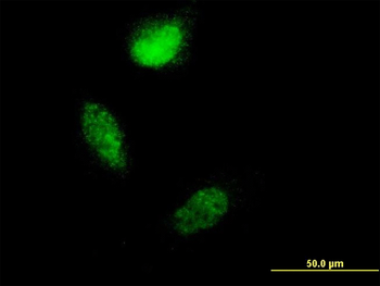 S100A4 monoclonal antibody (M01), clone 1F12-1G7