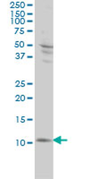 S100A4 monoclonal antibody (M01), clone 1F12-1G7