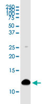 S100A4 monoclonal antibody (M01), clone 1F12-1G7
