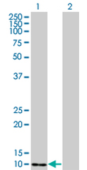 S100A4 monoclonal antibody (M01), clone 1F12-1G7