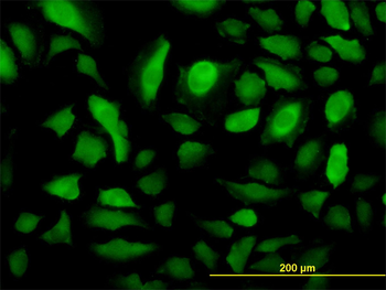 RRM2 monoclonal antibody (M01), clone 1E1