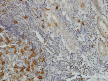 RRM2 monoclonal antibody (M01), clone 1E1