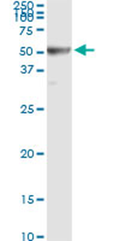 RRM2 monoclonal antibody (M01), clone 1E1