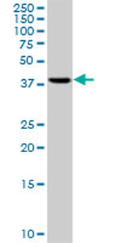 RRM2 monoclonal antibody (M01), clone 1E1