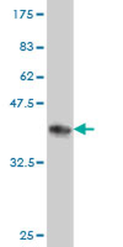 RRM2 monoclonal antibody (M01), clone 1E1