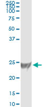 RRAS monoclonal antibody (M01), clone 2E12