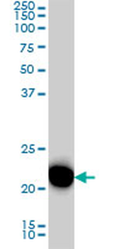 RRAS monoclonal antibody (M01), clone 2E12