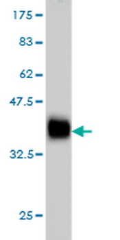 RRAS monoclonal antibody (M01), clone 2E12