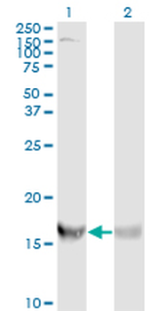 RPS19 monoclonal antibody (M01), clone 3C6