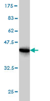 RPS19 monoclonal antibody (M01), clone 3C6