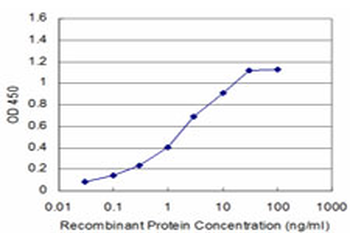 RPS6KB1 monoclonal antibody (M04), clone 4H4