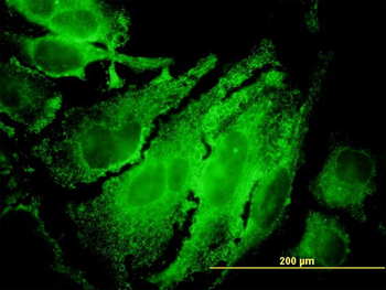 RPS6KB1 monoclonal antibody (M04), clone 4H4