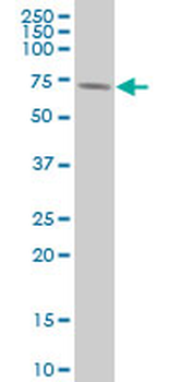 RPS6KB1 monoclonal antibody (M04), clone 4H4