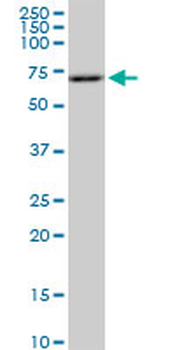 RPS6KB1 monoclonal antibody (M04), clone 4H4