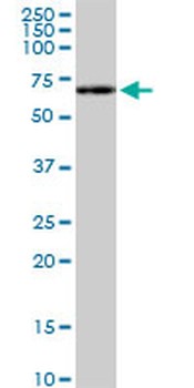 RPS6KB1 monoclonal antibody (M04), clone 4H4