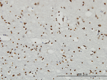 RPS6KA2 monoclonal antibody (M01), clone 1F6