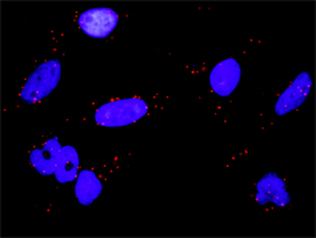 RPS6KA2 monoclonal antibody (M01), clone 1F6
