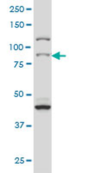 RPS6KA2 monoclonal antibody (M01), clone 1F6