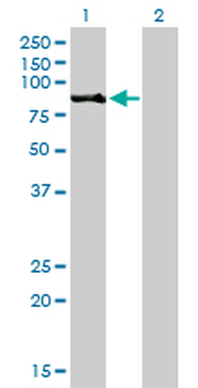 RPS6KA2 monoclonal antibody (M01), clone 1F6
